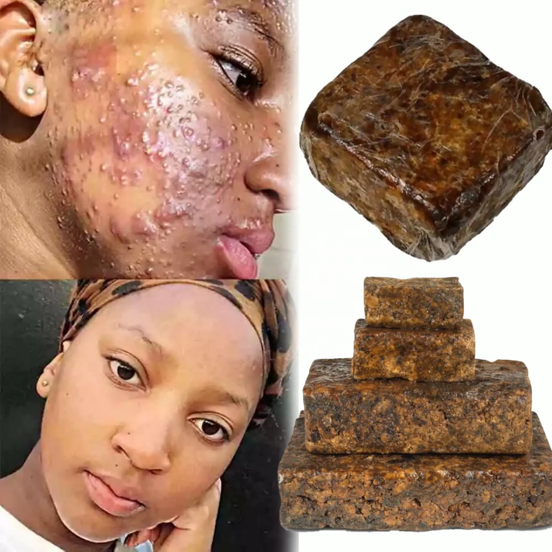 Savon noir africain Bio pour une peau douce et éclatante